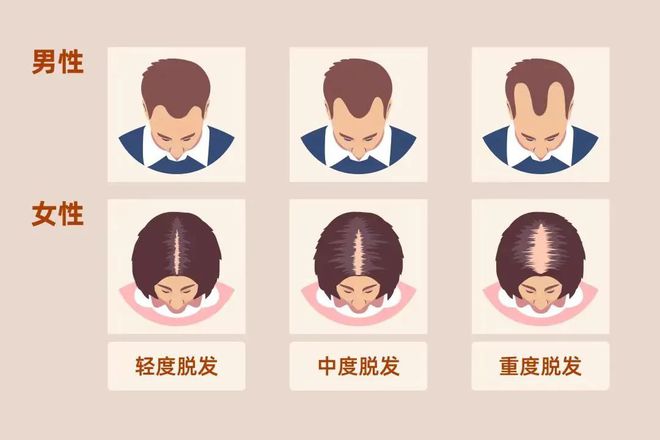 Bwin必赢假发丨男性相亲和职场的必胜法则(图1)