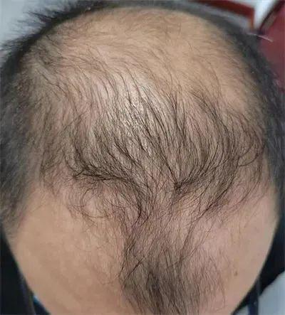 Bwin必赢假发丨男性相亲和职场的必胜法则(图2)