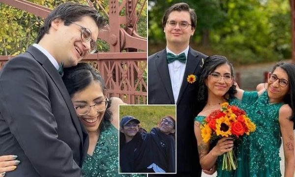 Bwin必赢美国连体姐妹一个坚决不嫁另一个刚结婚(图2)