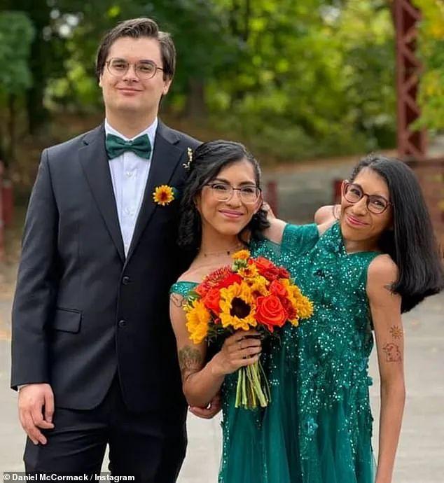 连体姐妹大婚震惊世界！一个为爱疯狂一个终生不嫁！专家：隐私问题基本无解(图1)