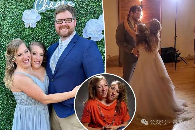 连体姐妹大婚震惊世界！一个为爱疯狂一个终生不嫁！专家：隐私问题基本无解(图18)