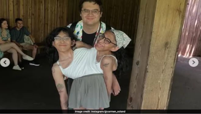 连体姐妹大婚震惊世界！一个为爱疯狂一个终生不嫁！专家：隐私问题基本无解(图16)